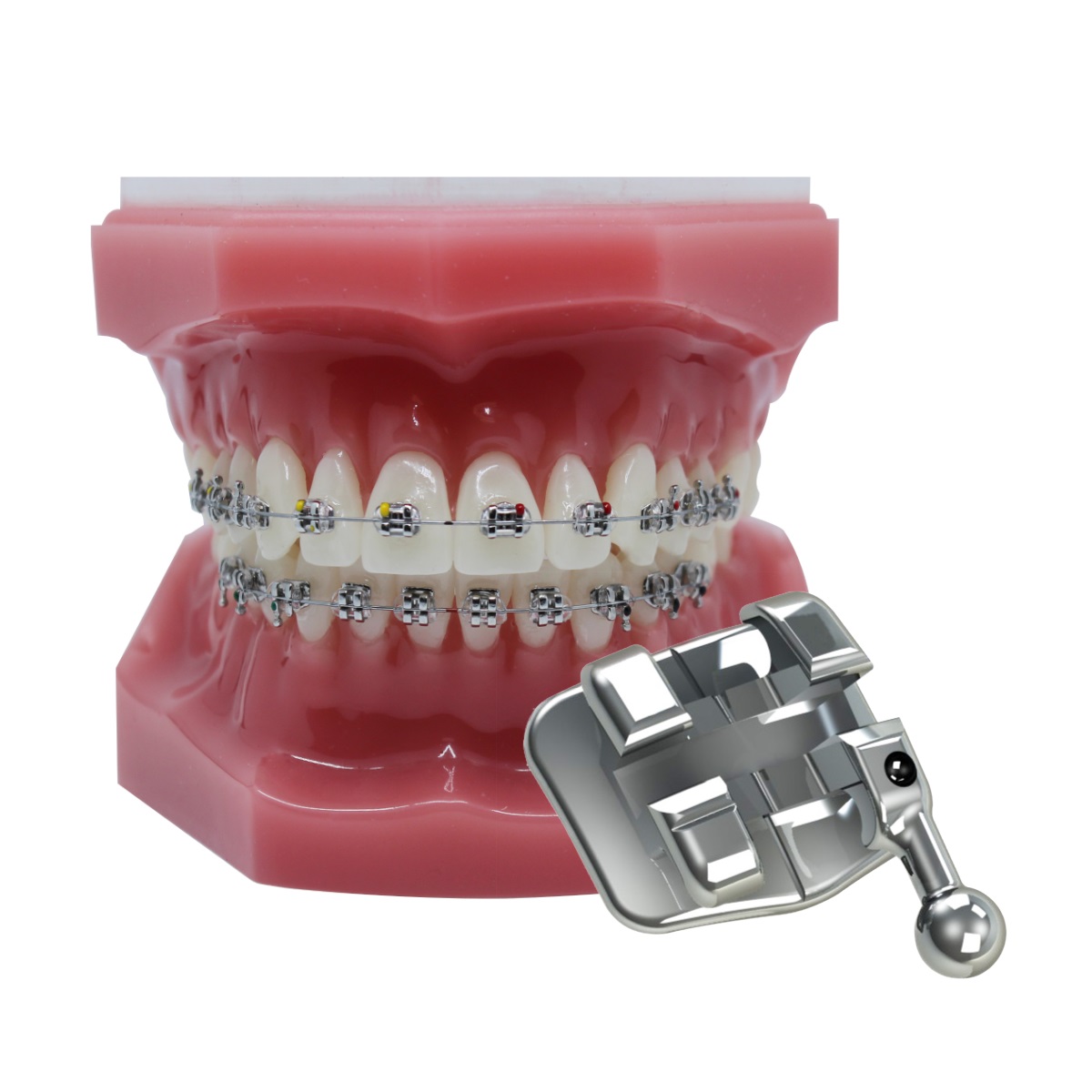 MicroTwin Low Profile Brackets MBT .022" 