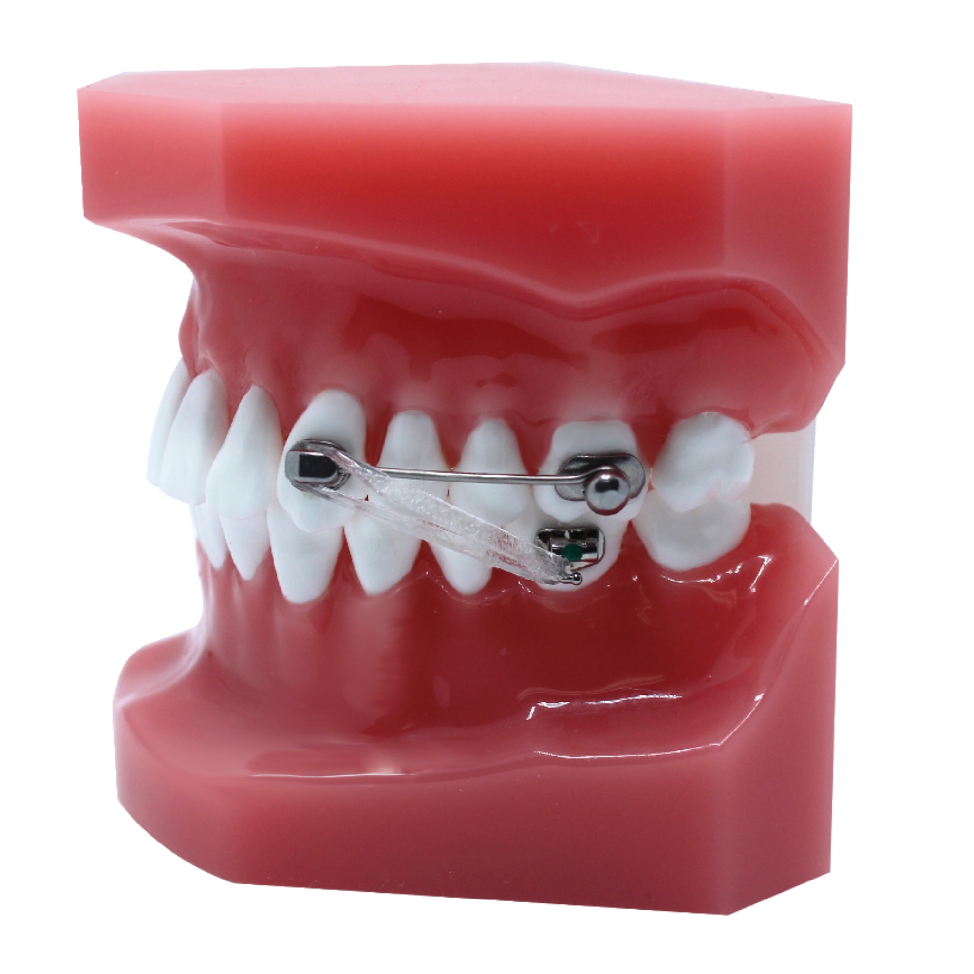 D2 Apparatur für Klasse II und III