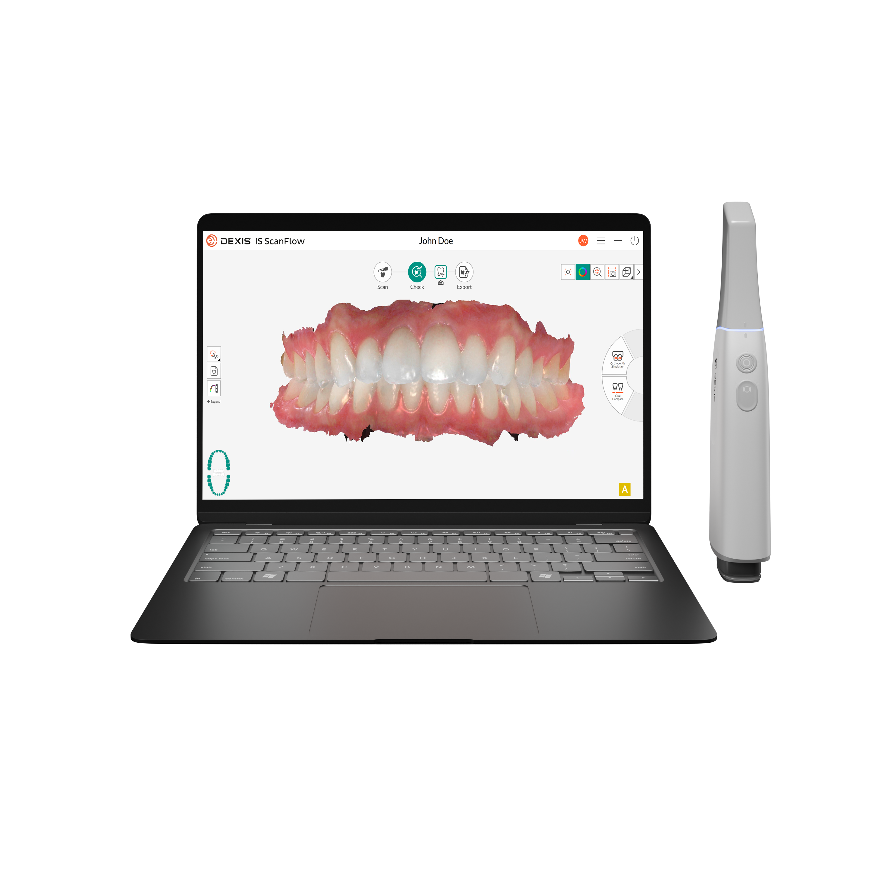 Intraoralscanner IMPREVO