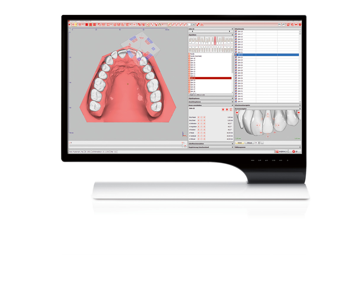 OnyxCeph 3™ Modul Aligner 3D