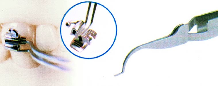 Setzhilfe für Tubes