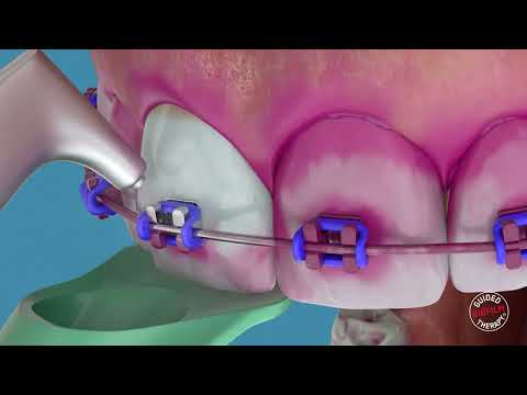 AIRFLOW® MAX Introduction Kit SMART