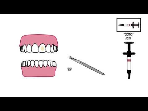GoTo, Paste in Tips
